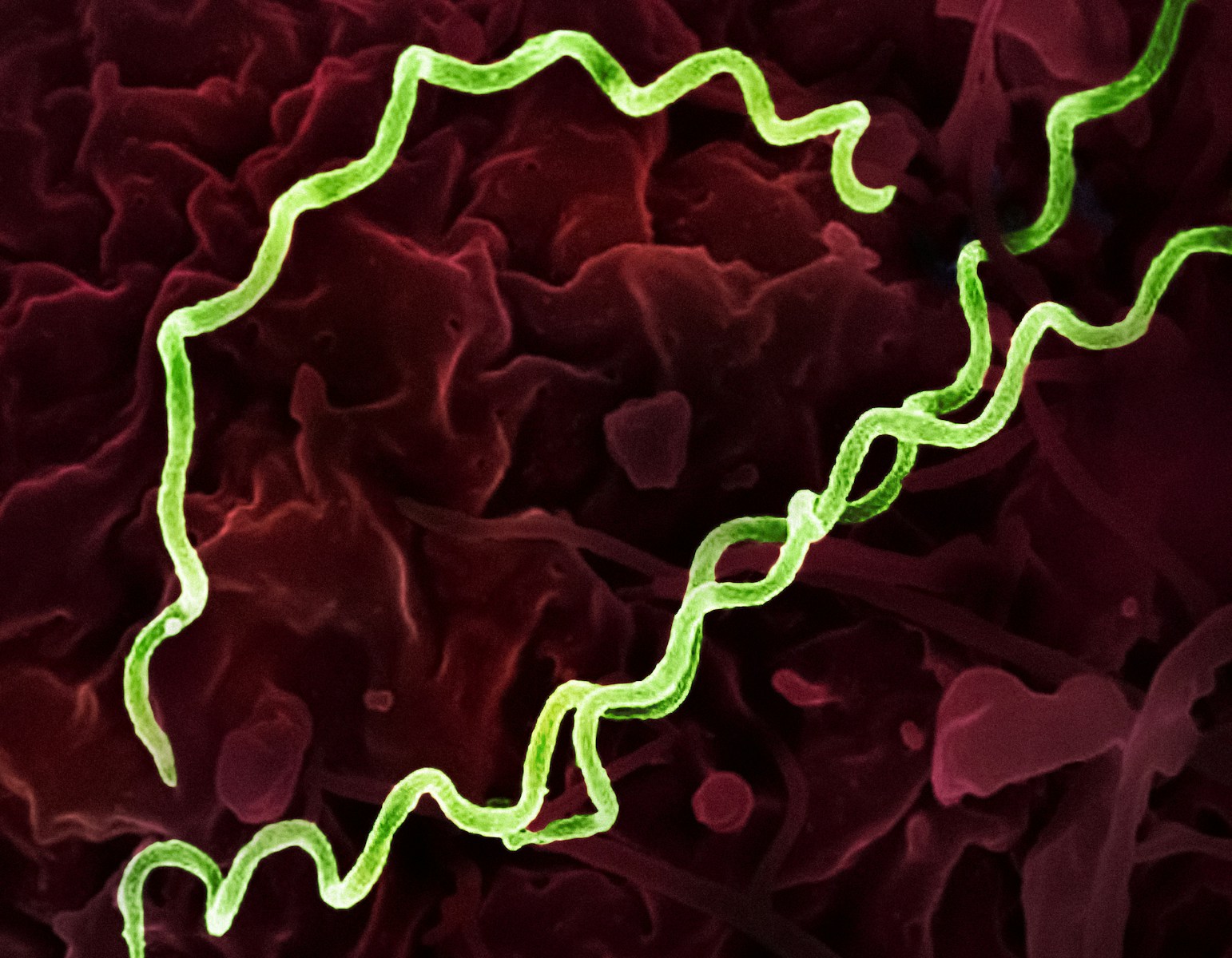 La sifilide al microscopio