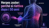 Herpes zoster: perché il virus della varicella si riattiva e colpisce gli over 50