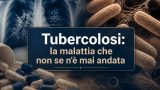 Tubercolosi: la malattia che non se n’è mai andata