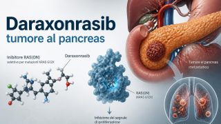 Tumore al pancreas: daraxonrasib raddoppia la sopravvivenza dopo la chemioterapia